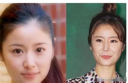 明星衰老对比照,明星衰老对比照揭示时光变迁