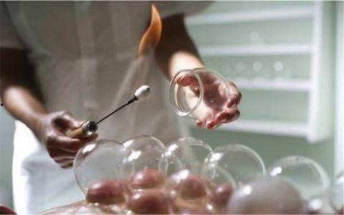 玻璃火罐拔罐视频教学